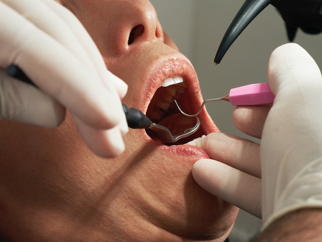 usunięcie chirurgiczne zęba